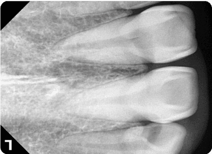 Handgun image xray
