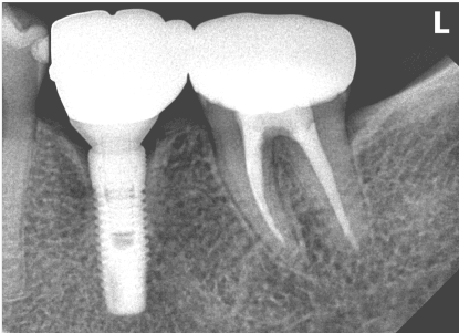 Vest image xray