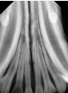 Icebox image xray