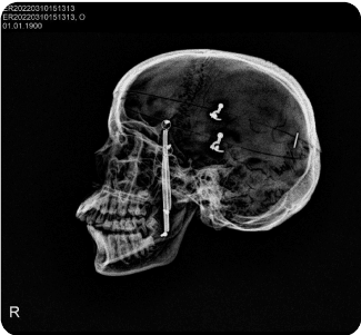 Handgun image xray