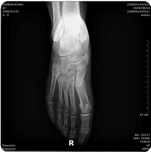Vest image xray