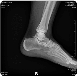 Icebox image xray