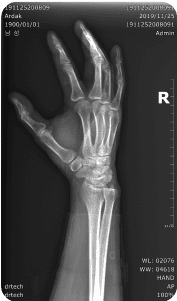 Handgun image xray