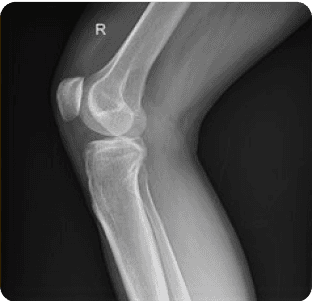 Handgun image xray
