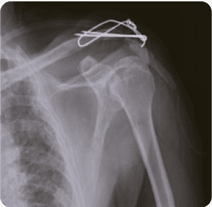 Handgun image xray