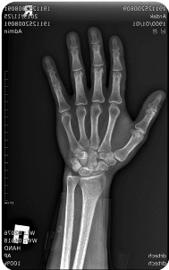 Handgun image xray