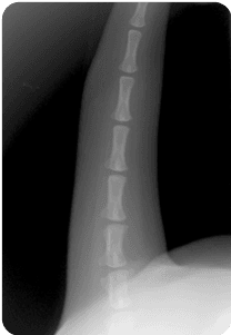 Handgun image xray
