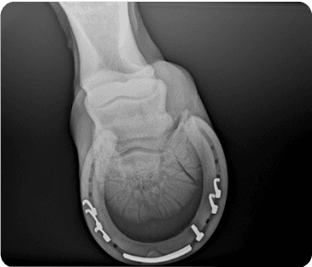 Vest image xray