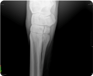 Icebox image xray