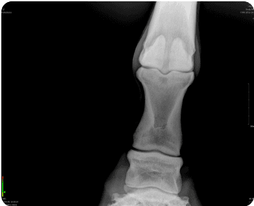Handgun image xray