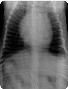 Handgun image xray